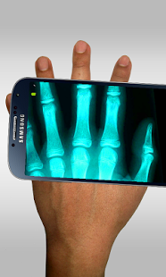 Download Xray Scanner Prank